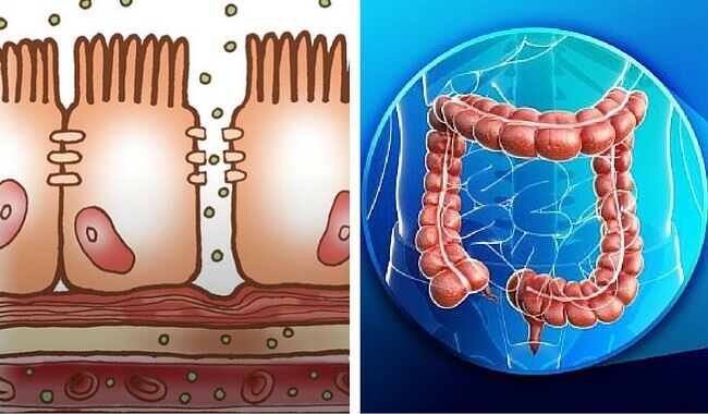 large intestine