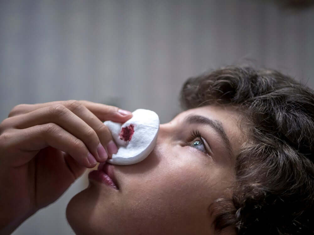 A woman with a nosebleed.