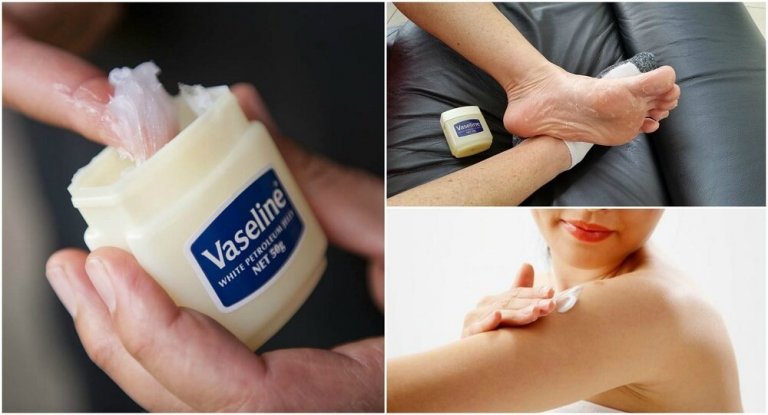 6 Medicinal Uses for Vaseline that You'll Want to Know