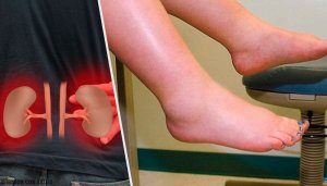 Water Retention: What Causes It?