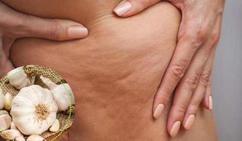 5 Ways to Fight Cellulitis