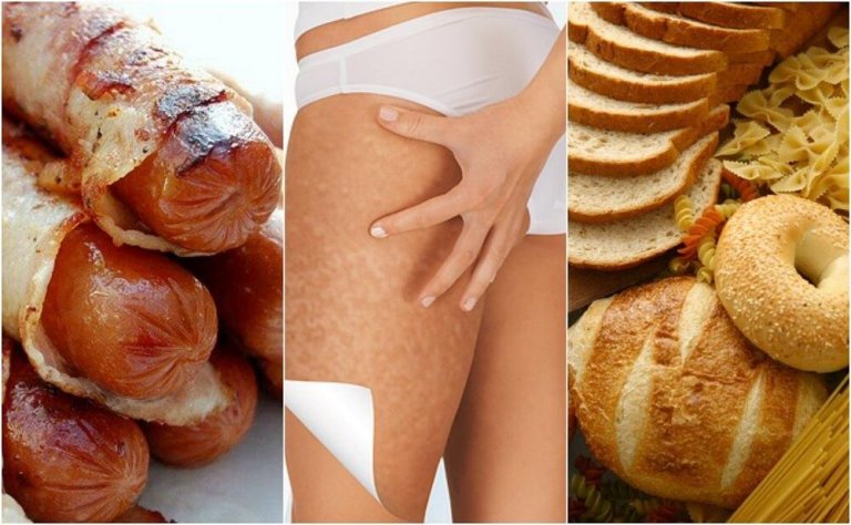 6 Foods that Worsen Cellulite