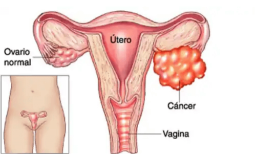 A drawing of female genitals.