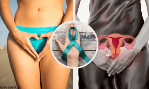 Detecting Ovarian Cancer
