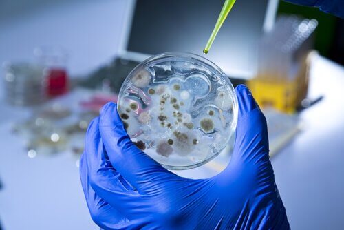 Sexually Transmitted Diseases