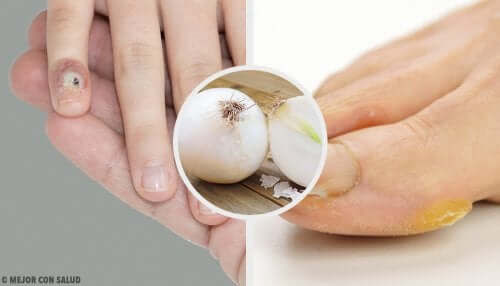 Remove Calluses from Hands and Feet Naturally
