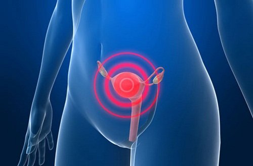 Detect cervical inflammation
