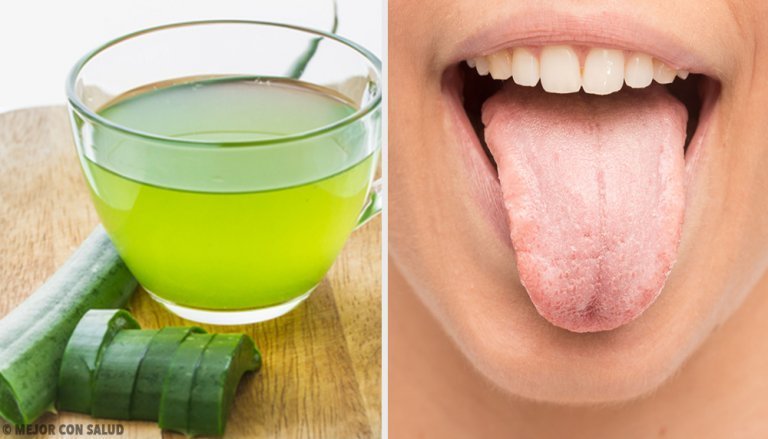 Seven Natural Remedies to Prevent White Tongue