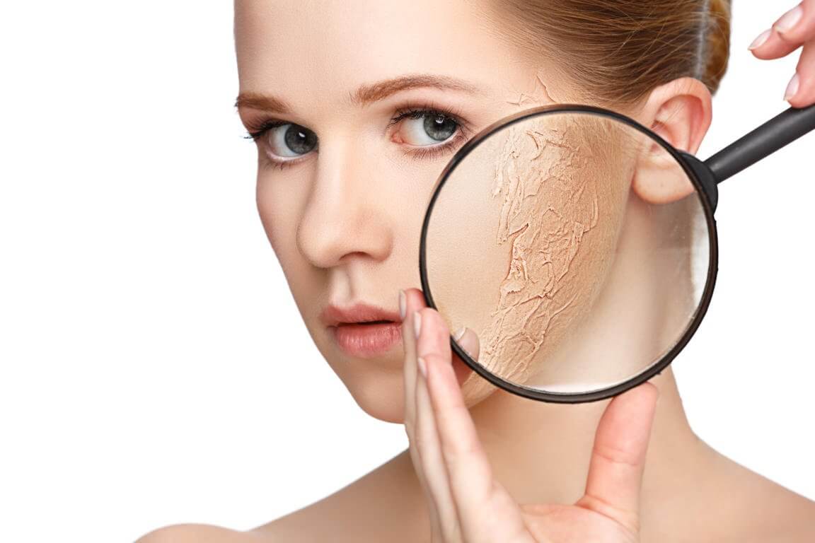 Treat-Dry-Skin