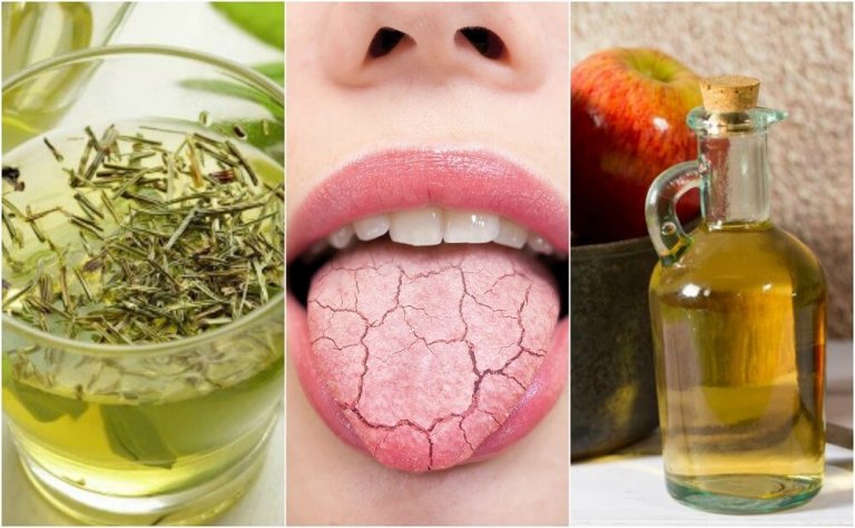 5 Homemade Remedies to Relieve a Dry Mouth