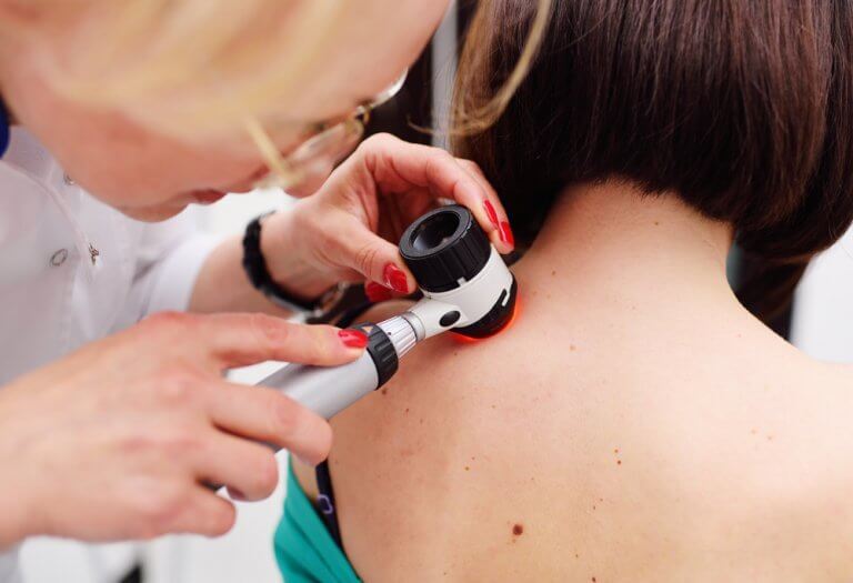 is melanoma the only kind of serious skin cancer