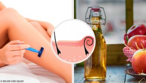5 Natural Remedies for Irritation After Shaving