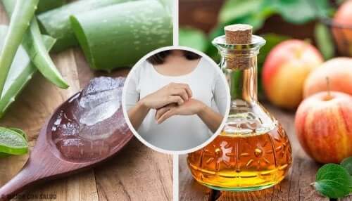 15 Natural Remedies for Fungal Skin Infections