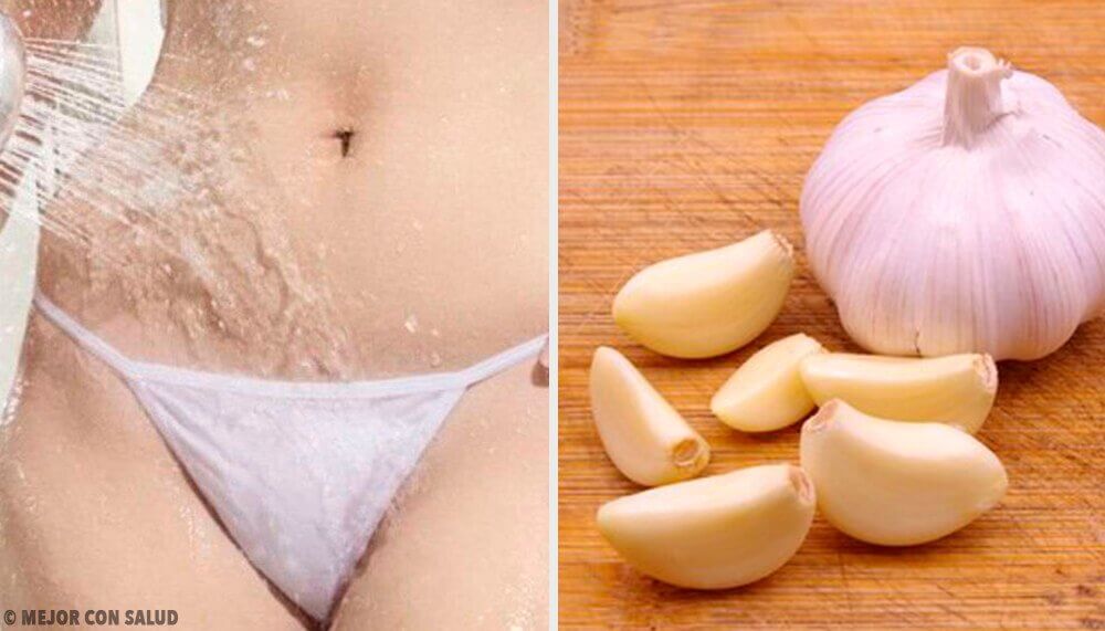 3 Garlic-Based Remedies for Treating Vaginal Yeast Infections