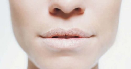 A woman with dry lips.