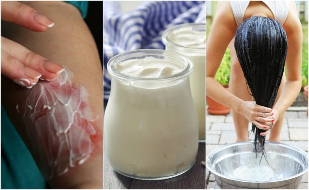 6 Ways to Use Natural Yogurt in Homemade Remedies