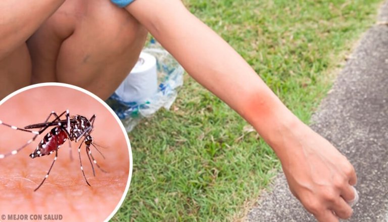 What Happens when You Get a Mosquito Bite?