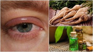5 Home Remedies To Relieve Swollen Eyelids