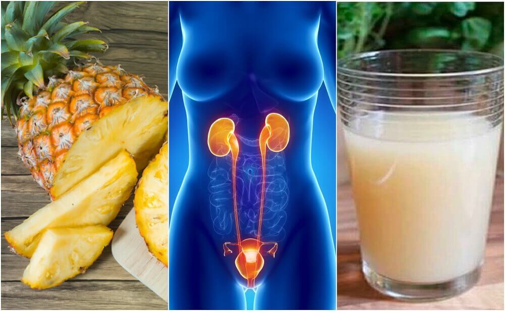 7 Natural Solutions For Urinary Tract Infections Step To Health 0755