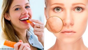 9 Foods for Skin Care
