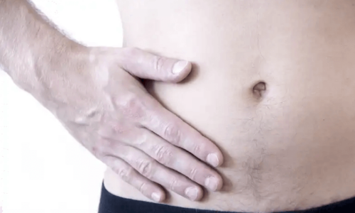 A man with a hernia.