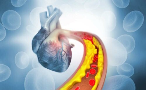 An image of a heart with bad cholesterol.