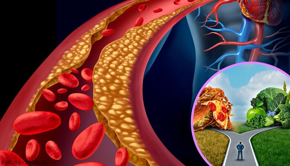 Optimal level of cholesterol and its variants