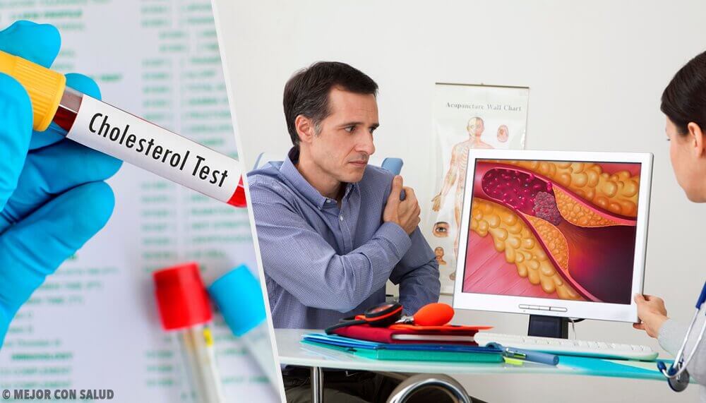 When Should You Start Worrying About Optimal Cholesterol Levels?