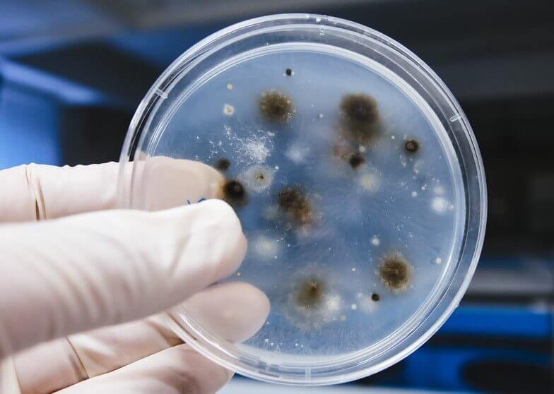 Fungal Infections