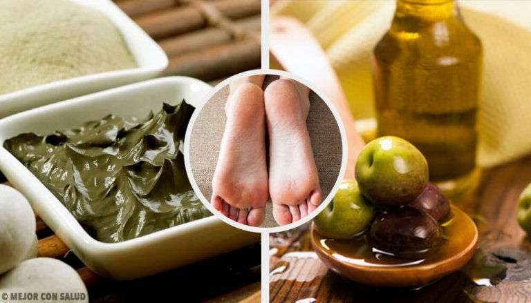 Moisturize Your Dry Heels with These Incredible Home Remedies