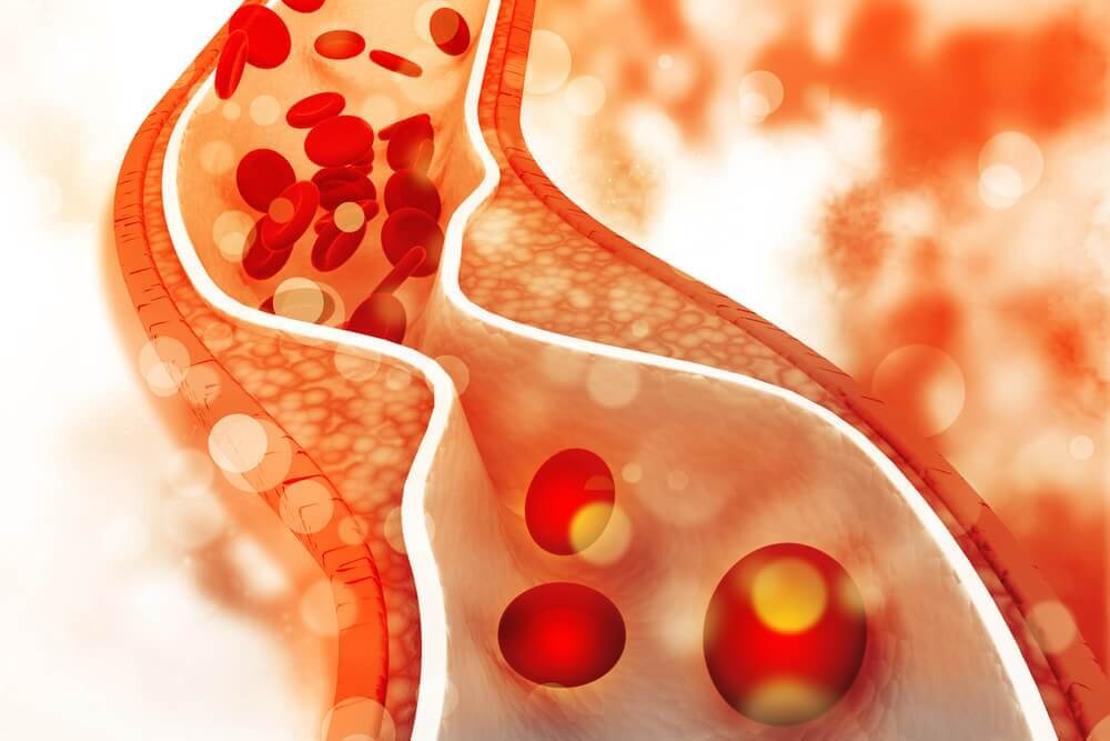 Control Your Bad Cholesterol Levels with a Healthy Diet