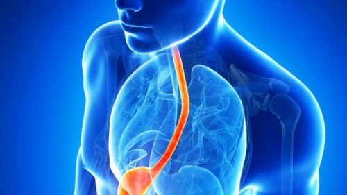 The Most Effective Natural Remedies to Treat Reflux