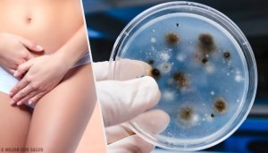 Vaginal Infections: The Types and Causes