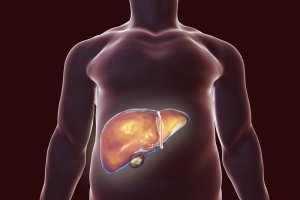 The Best Natural Remedies to Help Detox Your Liver