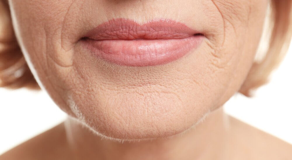 Wrinkles under the nose