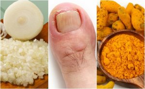 Make These 6 Inflamed Hangnail Remedies at Home
