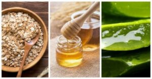 Effective Natural Remedies for Seborrheic Dermatitis