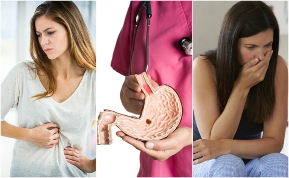 10 Symptoms of a Peptic Ulcer