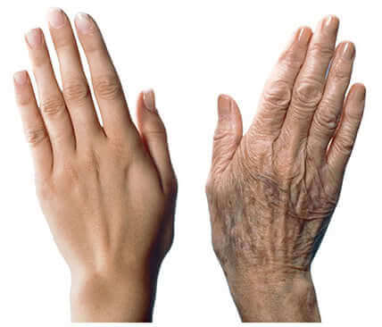 7 Recommendations to Care for Aging Hands