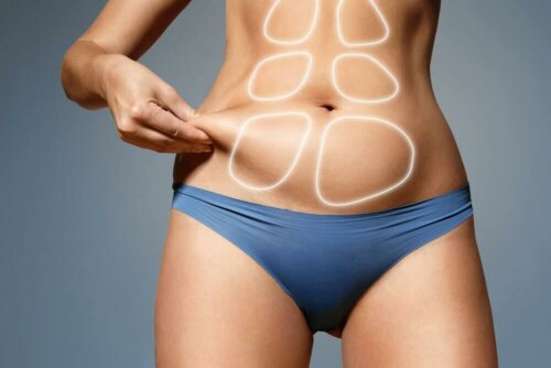 Is There a Way to Correct Diastasis Recti?