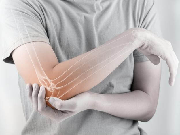 rheumatoid arthritis