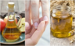 Treat Brittle Nails with These 5 Home Nail Remedies