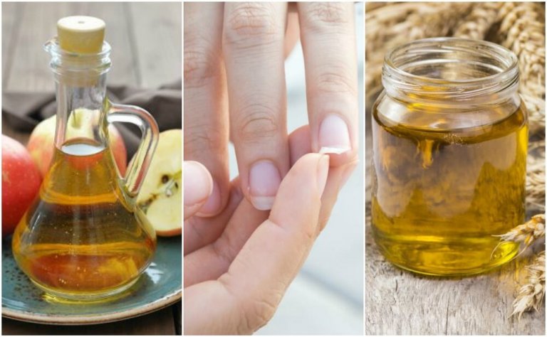 Treat Brittle Nails with These 5 Home Nail Remedies