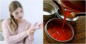 Anti-inflammatory Cayenne Pepper Ointments for Joint Pain