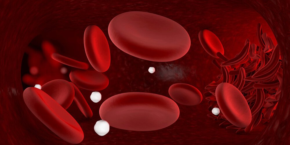 No-fail Homemade Remedies for Anemia No-fail Homemade Remedies for Anemia