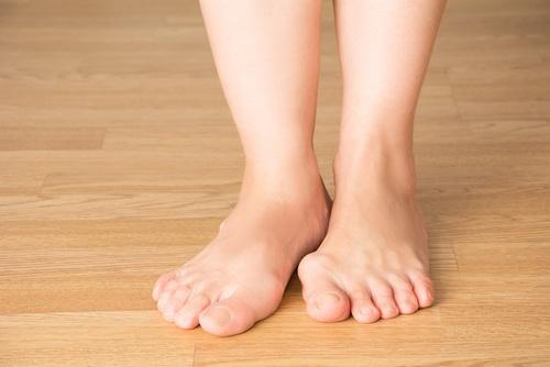 bunions