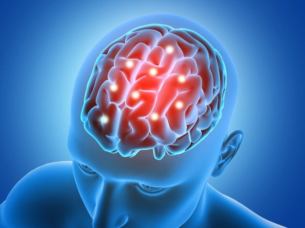 Brain Activity