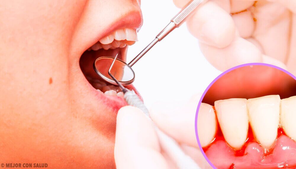 gum infections