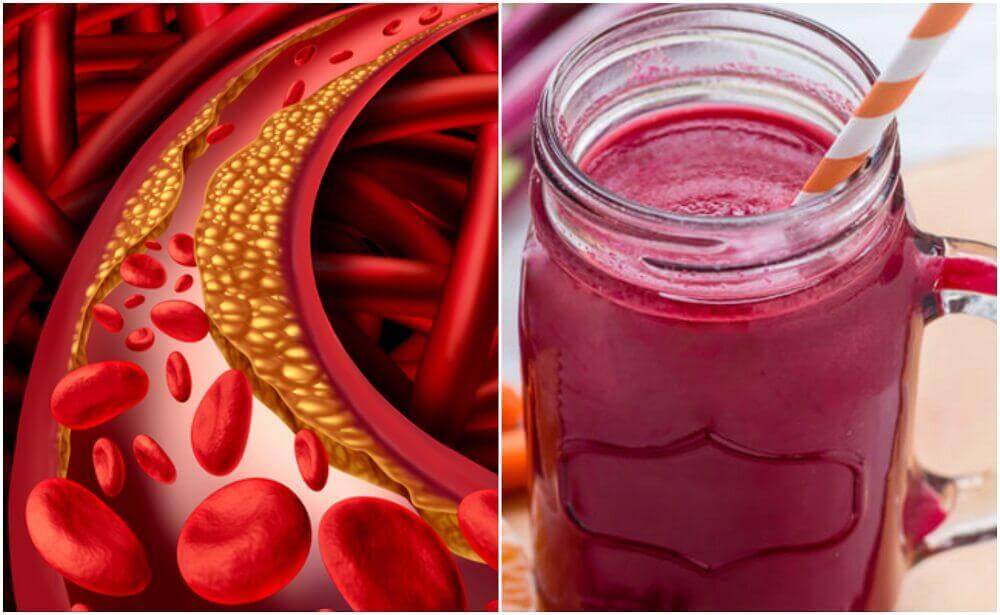 How to Make a Special Beet Smoothie to Control Cholesterol