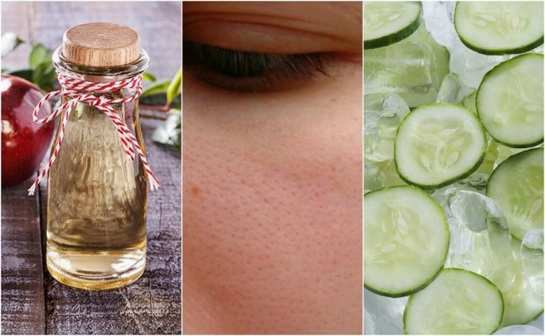 6 Natural Ways to Close Your Pores